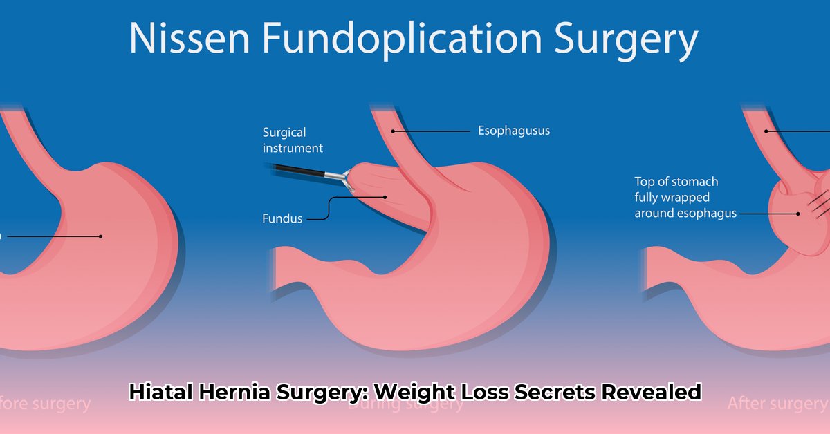 hiatal-hernia-surgery-and-weight-loss